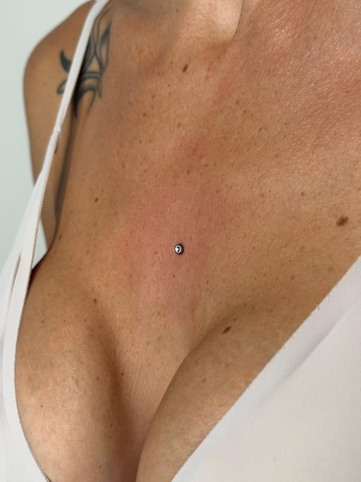 Microdermal sul petto
